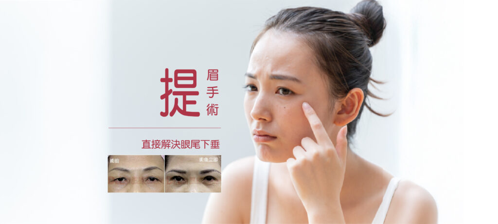 提眉手術